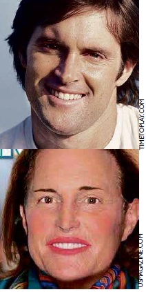 BEFORE AND AFTER. Bruce Jenner in the early ’80s, and as she appears now after a series of cosmetic surgeries and hormone treatments