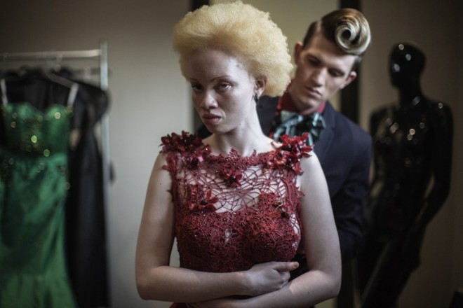 South African lawyer and part-time fashion model Thando Hopa (L), an albino, tries on an evening dress by South African fashion designer Gert-Johan Coetzee (R) during a mock-up fitting session at his workshop on June 13, 2015 in Johannesburg. Thando Hopa grew up in the shade, her porcelain skin hidden under long sleeves and sunscreen until the day this South African said goodbye to her complexes and decided to fight prejudice against albinos by becoming a model. Petite and born with a genetic anomaly that left her skin de-pigmented from head to toe, Hopa entered the fashion world without the usual vital statistics required of a catwalk model. But ghostly, no make-up barring a vivid fuchsia on her lips, her hair sculpted to a magnificent bleached height, she exploded onto the cover of the first Forbes Life Africa back in 2013. AFP PHOTO 