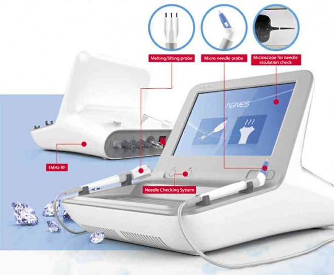 THE AGNES laser machine targets recurring pimples by zeroing in on the source. By using a broader tip, the attending doctor can also make patient’s acne scars look less pronounced.