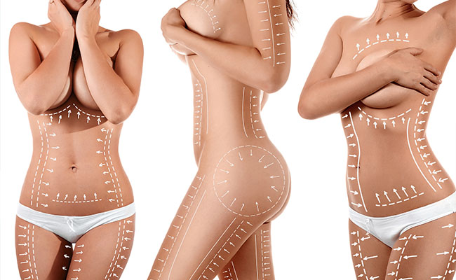 Best Liposuction in The Philippines 2019