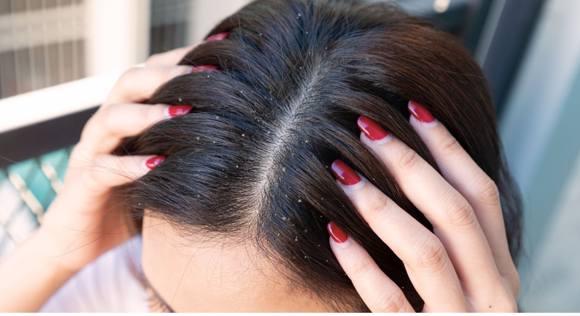 What other anti-dandruff shampoos don’t tell you about hair care