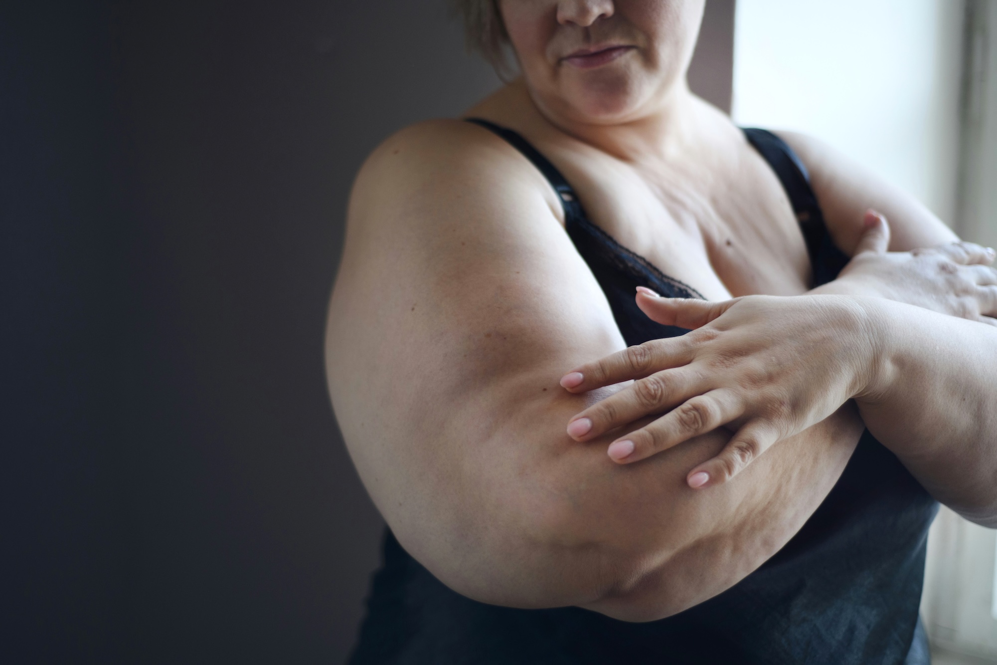 BMI been used for decades by the medical field as a way to quickly gauge if someone's body is in a "normal" range | Photo from Getty Images/Unsplash+